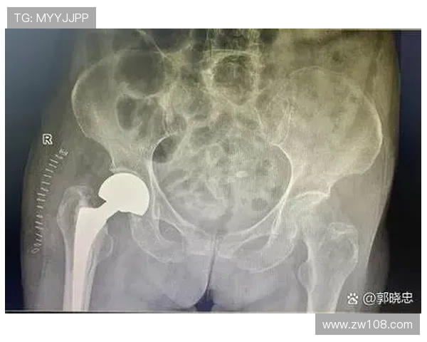主刀医生称阿萨莫阿术后恢复良好预计三个月内康复重返赛场无大碍