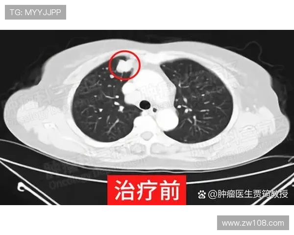 球员黄威手术时间确定预计十月十日实施手术方案进展顺利 球员黄威手术时间确定预计十月十日实施手术方案进展顺利